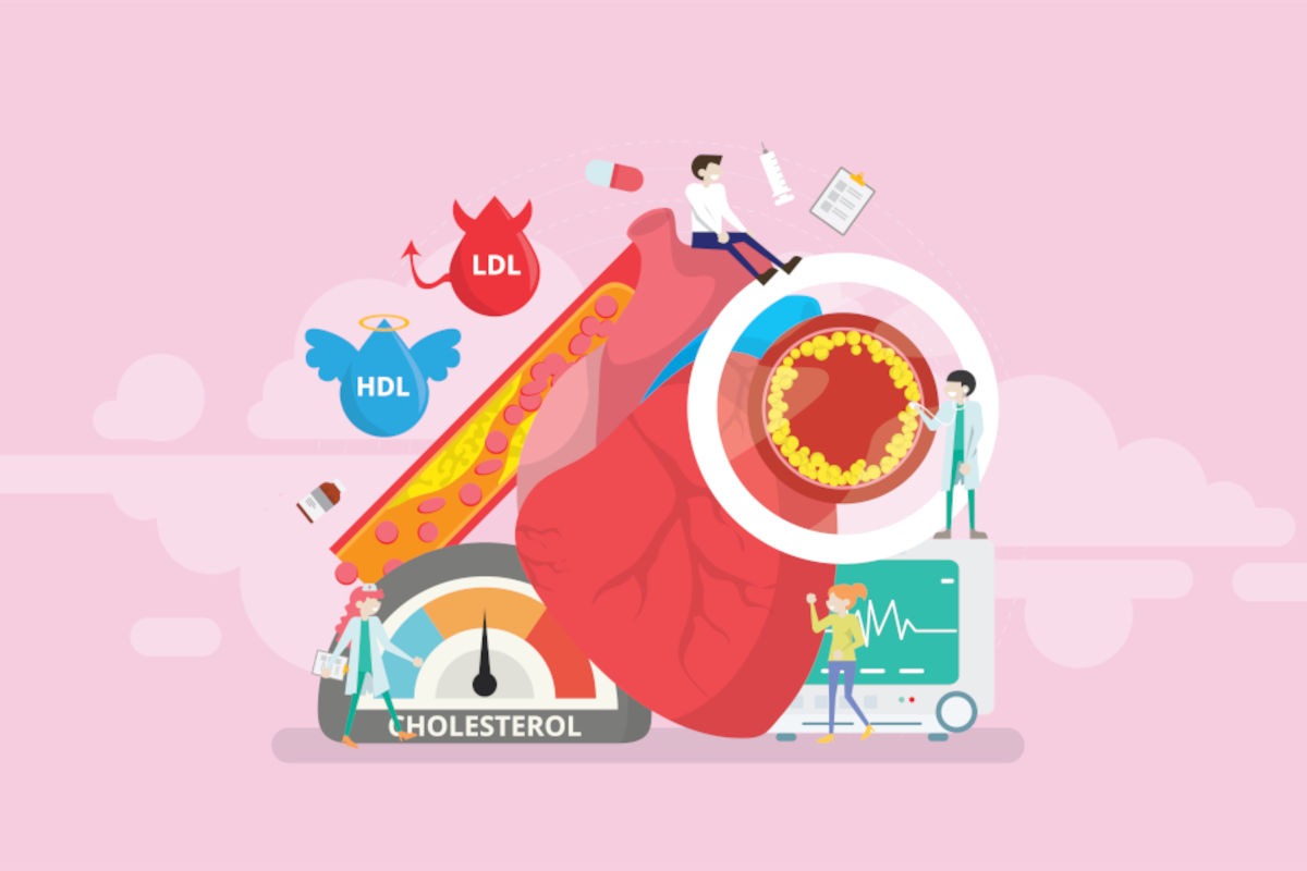 Colesterolo, a quale età iniziare a misurarlo? Il consiglio degli esperti