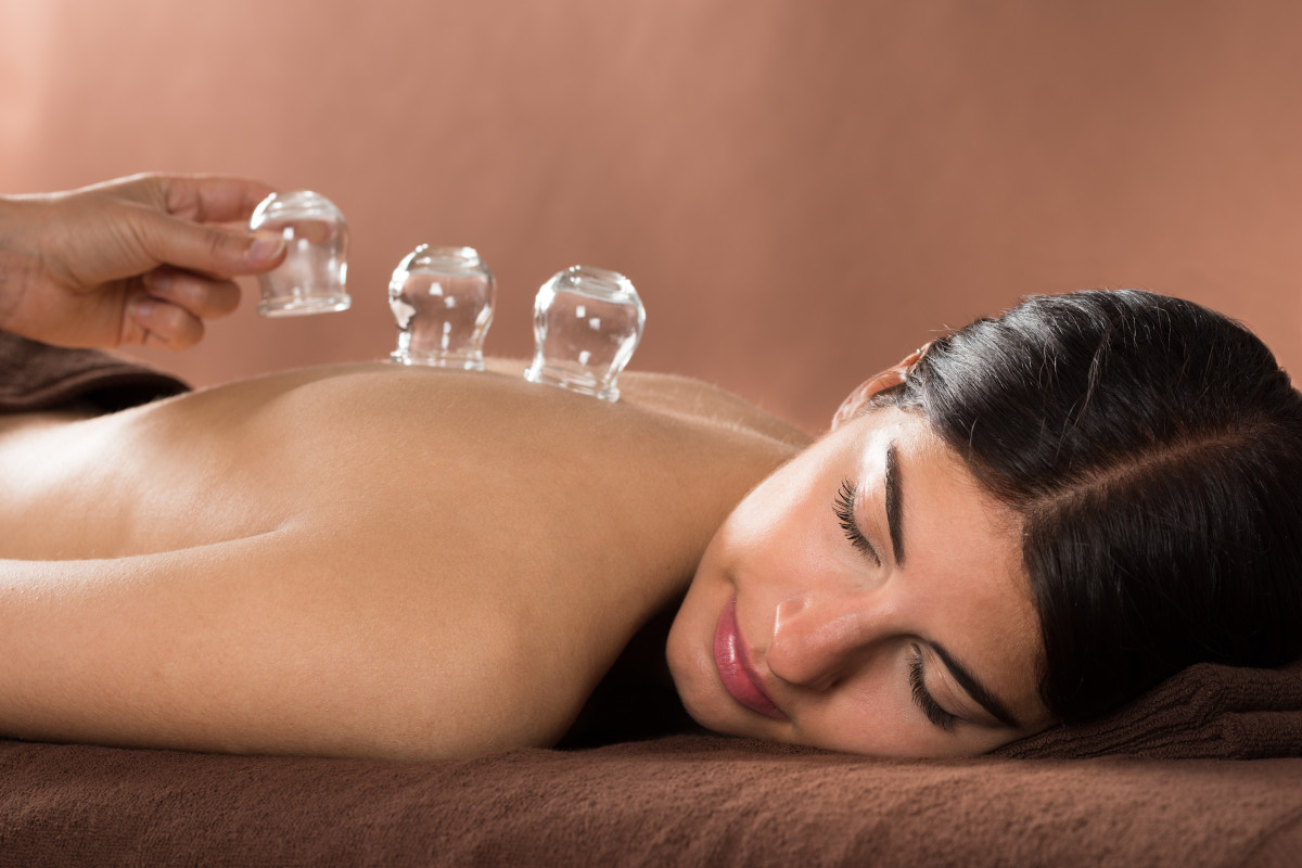 Cupping, la terapia antidolorifica che si applica alla pelle Dolori muscolari? Mai provato il Cupping